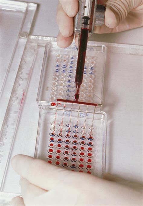 elisa test upsc|elisa blood test.